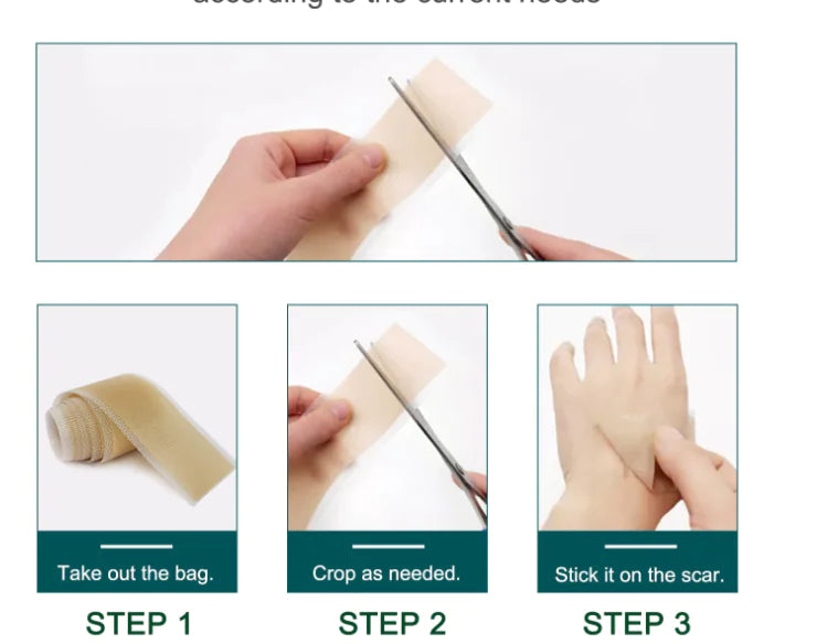 THEFLASHFINDERS™ Scar Fix – Enkel & Effektiv