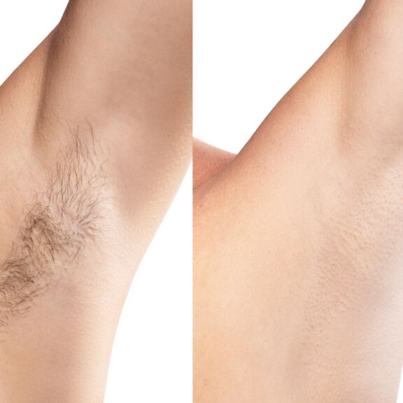 theflashfinders™ – 2-i-1-rakapparat för kvinnor