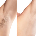 theflashfinders™ – 2-i-1-rakapparat för kvinnor