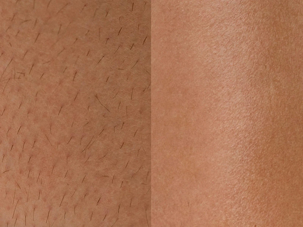 theflashfinders™ – 2-i-1-rakapparat för kvinnor