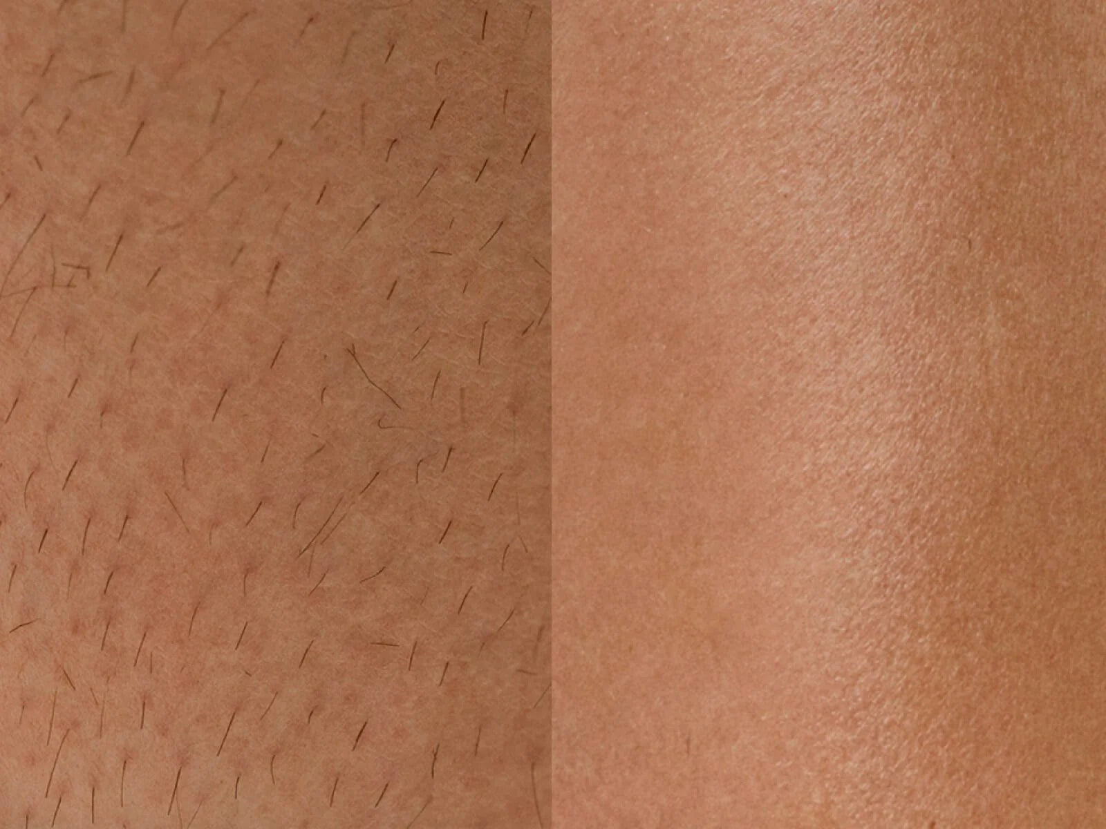 theflashfinders™ – 2-i-1-rakapparat för kvinnor